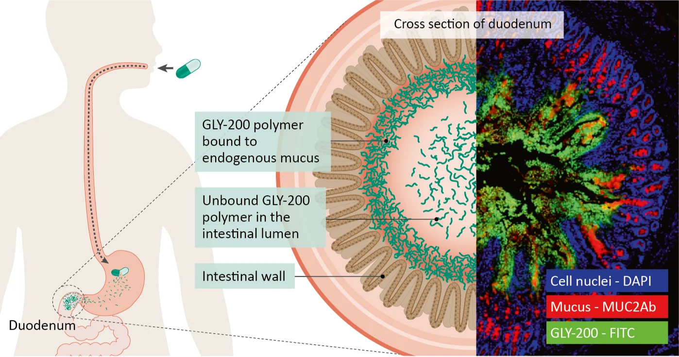 Novel mucin-complexing polymers for the treatment of type 2 diabetes and obesity